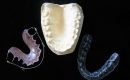 Molde y placa de contención dental
