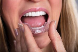 Mueven los dientes - Mujer con placa de relajación