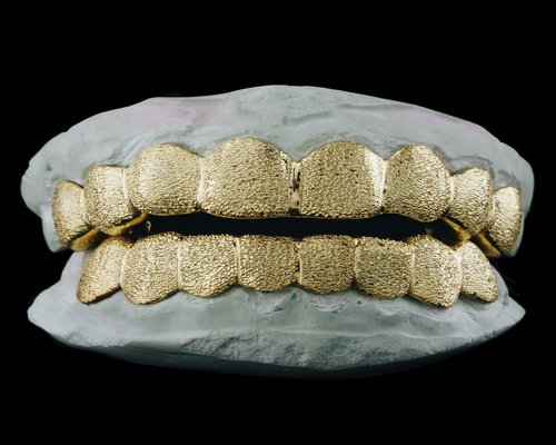 Imagen de dentadura con oro y diamantes