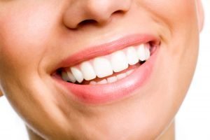 Mitos sobre salud dental - Sonrisa blanca